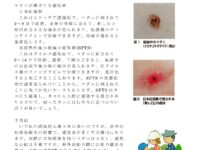 マダニによる感染症