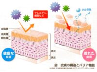 健康セミナー｜皮膚の機能と感染症